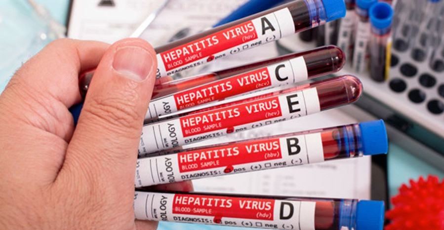 Hepatitisz